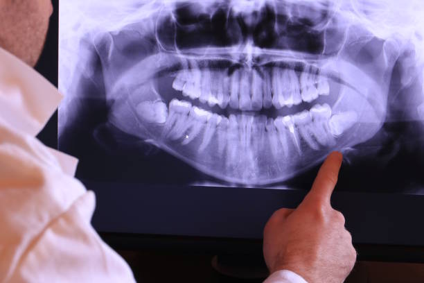 Best Emergency Denture Repair in Johnston City, IL